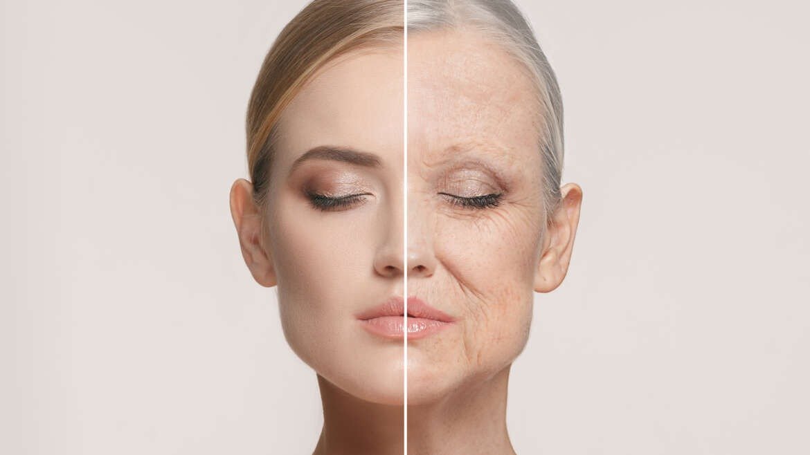 Peeling para Flacidez