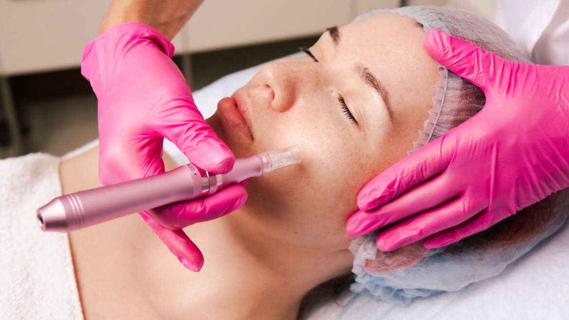 Curso On Line Especialista en Dermapen y Bbglow