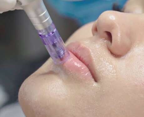 BB Lips - Hydra Gloss Lips - Peeling Lips